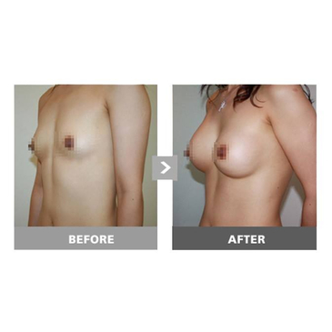 Slider image (5) HERSHE Plastic Surgery and Dermatology